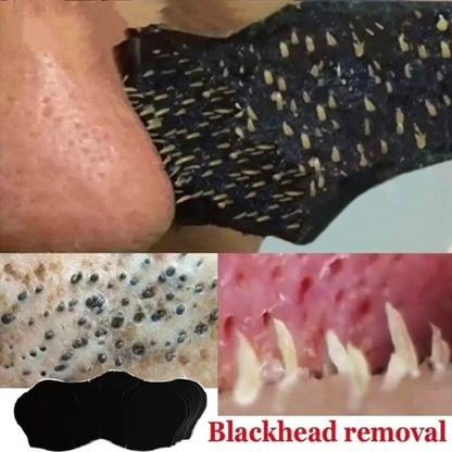 Blackhead Removal Nose Mask - 5/10/15/20 Pieces